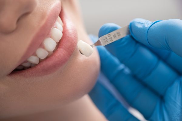 Myths And Facts About Cavities