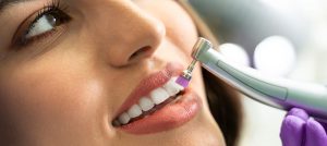 dental cleaning in Springfield