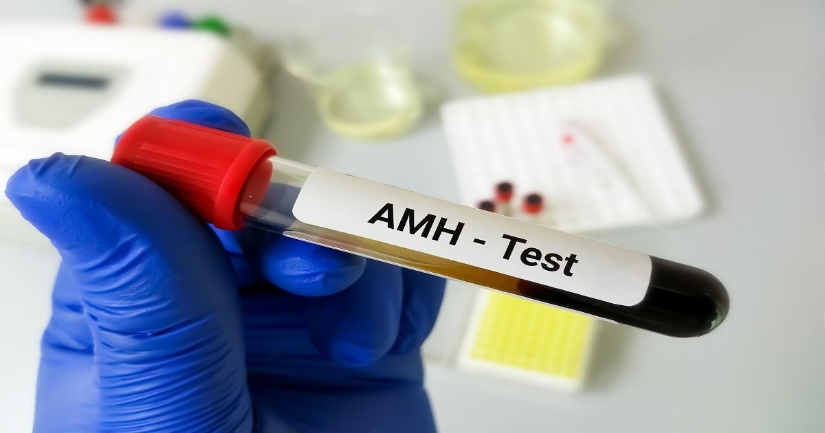 AMH blood test
