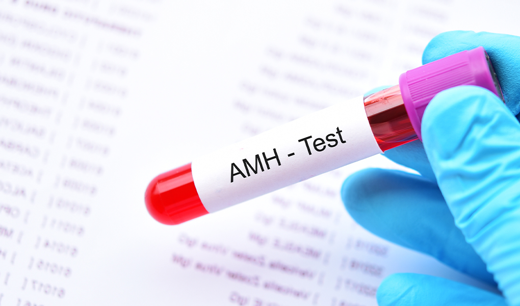 Get to learn what an AMH Test is